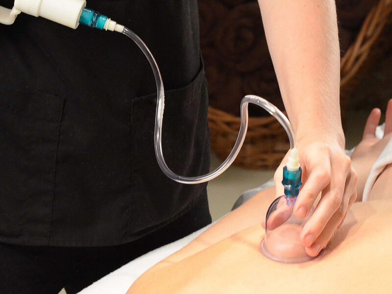 Cupping 2852483 1920 E1619222081452